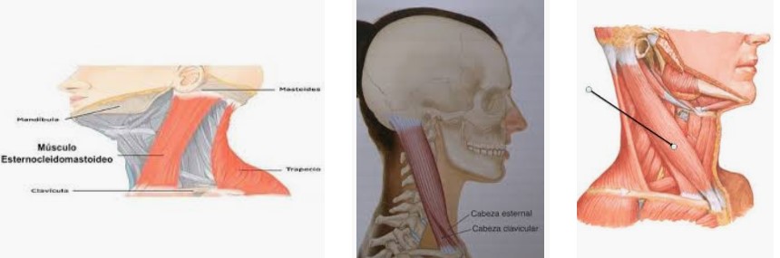 Esternocleidomastoideo (Sternocleidomastoideus) 1 Esternocleidomastoideo