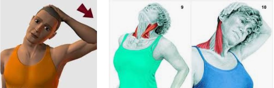 Esternocleidomastoideo (Sternocleidomastoideus) 3 estiramiento esternocleidomastoideo